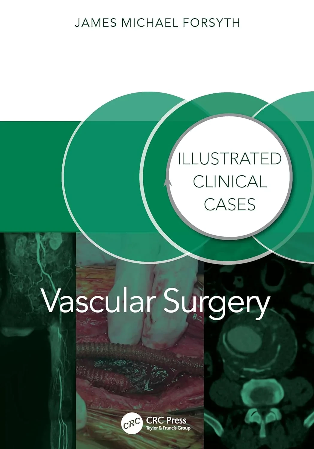Coperta cărții "Vascular Surgery: Illustrated Clinical Cases" de James Forsyth