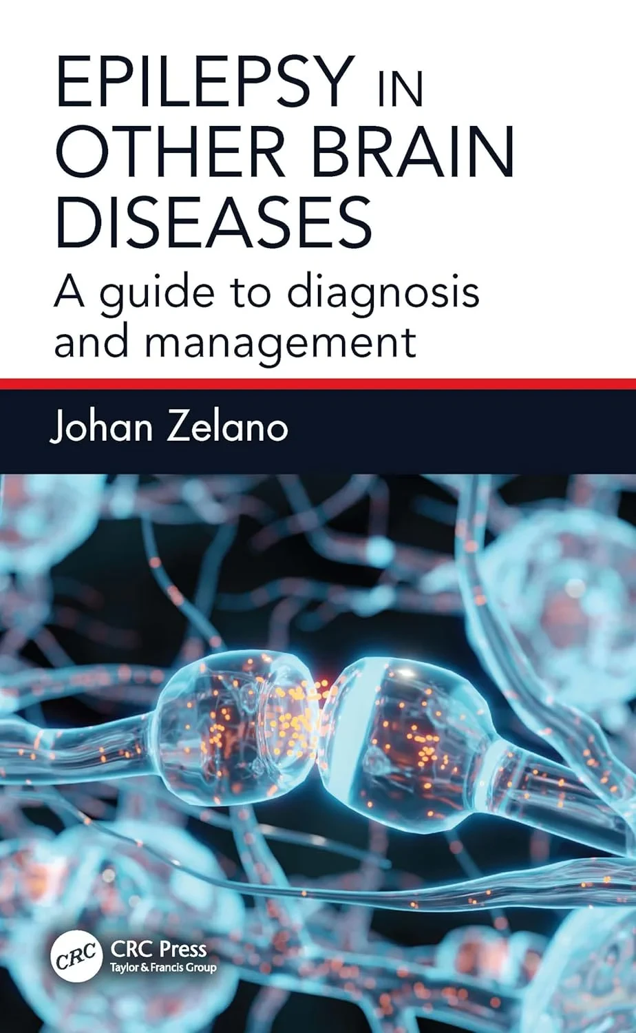 Coperta cărții "Epilepsy in Other Brain Diseases: A Guide to Diagnosis and Management " de Johan Zelano