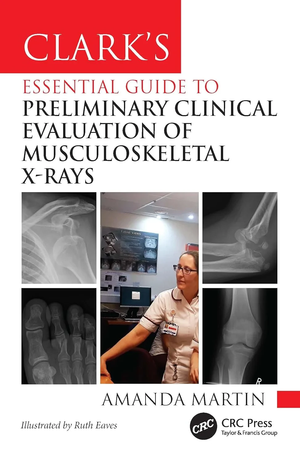 Coperta cărții "ClarkÂ’s Essential Guide to Preliminary Clinical Evaluation of Musculoskeletal X-rays: Evaluating and Commenting on Images (Clarkâ€™s Companion Essential Guides) 1st Edition" de Amanda Martin, Amanda Martin Ilustrat de Ruth Eaves