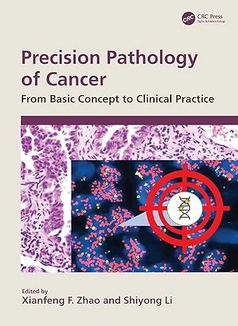 Coperta cărții "Precision Pathology of Cancer: From Basic Concept to Clinical Practice" de Xianfeng F. Zhao, Shiyong Li