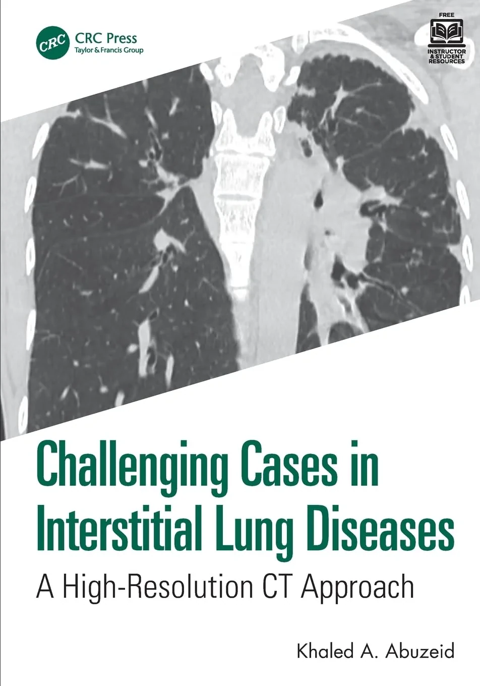 Coperta cărții "Challenging Cases in Interstitial Lung Diseases: A High-Resolution CT Approach" de Khaled A. Abuzeid