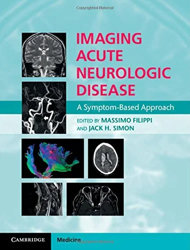 Coperta cărții "Imaging Acute Neurologic Disease: A Symptom-Based Approach" de Massimo Filippi, Jack H. Simon