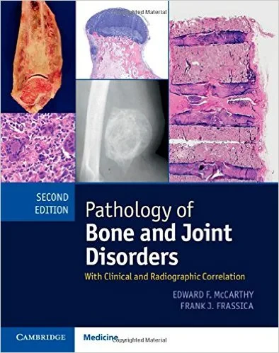 Coperta cărții "Pathology of Bone and Joint Disorders Print and Online Bundle: With Clinical and Radiographic Correlation 2nd Edition" de Edward F. McCarthy, Frank J. Frassica