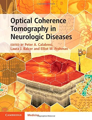 Coperta cărții "Optical Coherence Tomography in Neurologic Diseases" de Peter A. Calabresi, Laura J. Balcer, Elliot M. Frohman