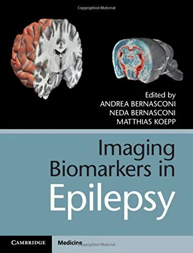 Coperta cărții "Imaging Biomarkers in Epilepsy" de Andrea Bernasconi, Neda Bernasconi, Matthias Koepp