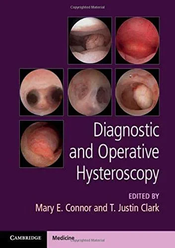 Coperta cărții "Diagnostic and Operative Hysteroscopy" de Mary E. Connor, T. Justin Clark