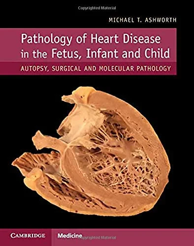 Coperta cărții "Pathology of Heart Disease in the Fetus, Infant and Child" de Michael T. Ashworth