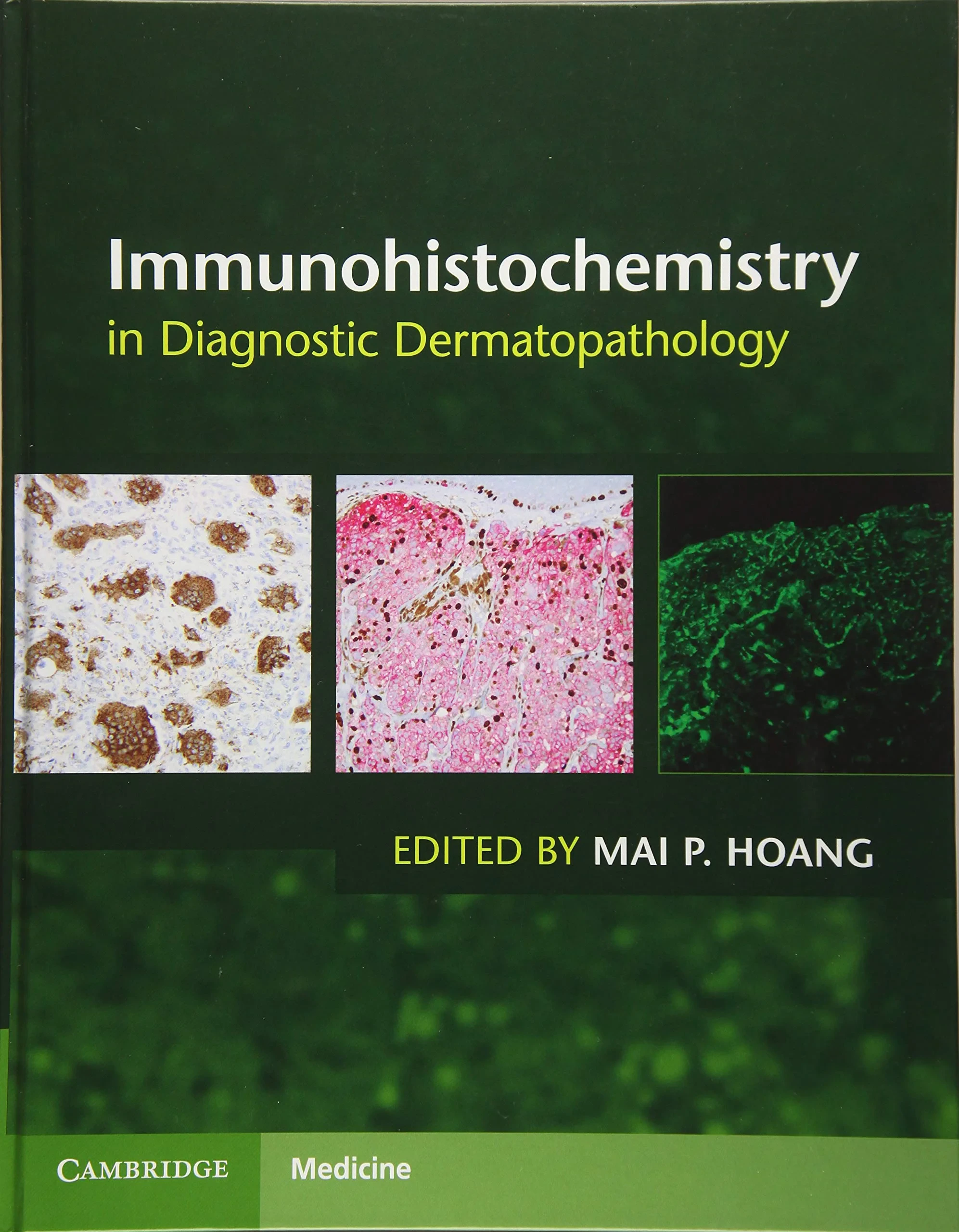 Immunohistochemistry in Diagnostic Dermatopatholog...