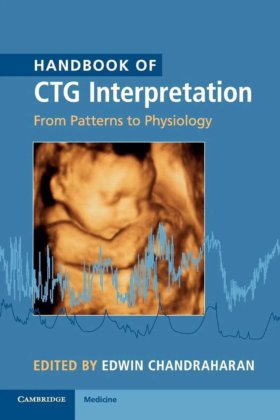 Coperta cărții "Handbook of CTG Interpretation: From Patterns to Physiology" de Edwin Chandraharan
