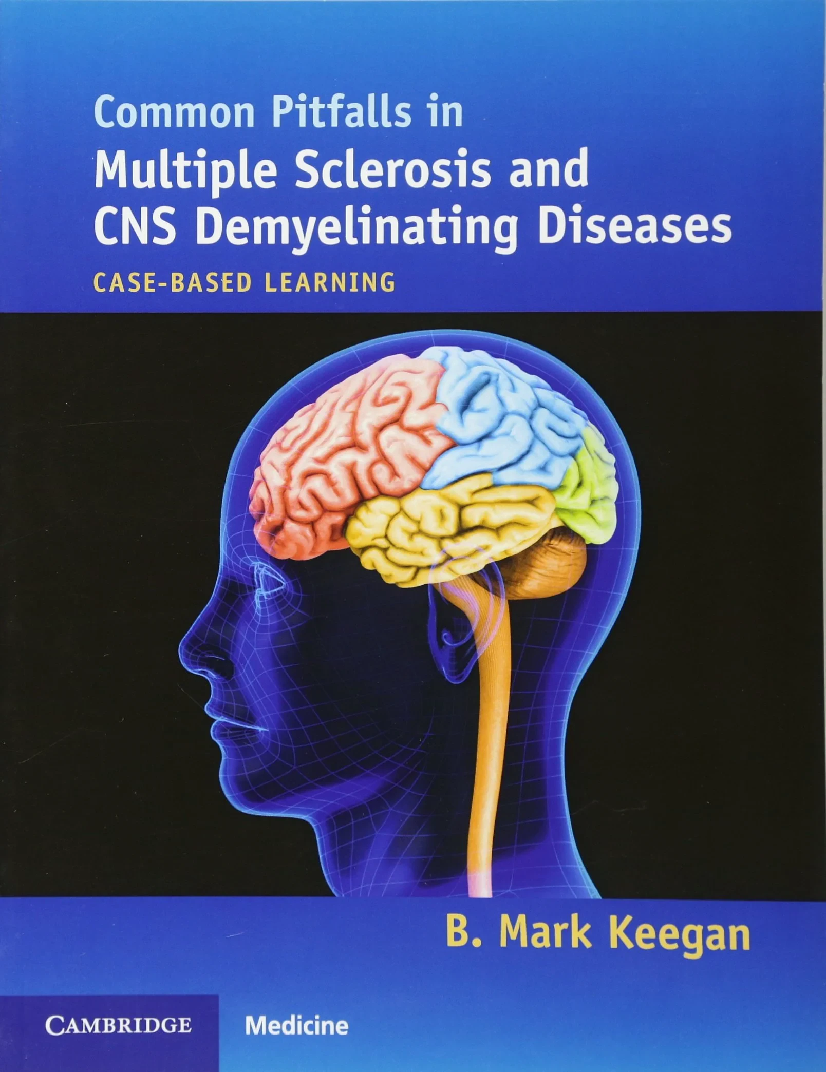 Coperta cărții "Common Pitfalls in Multiple Sclerosis and CNS Demyelinating Diseases" de B. Mark Keegan