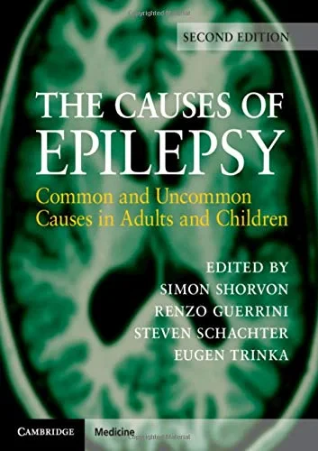 The Causes of Epilepsy: Common and Uncommon Causes...
