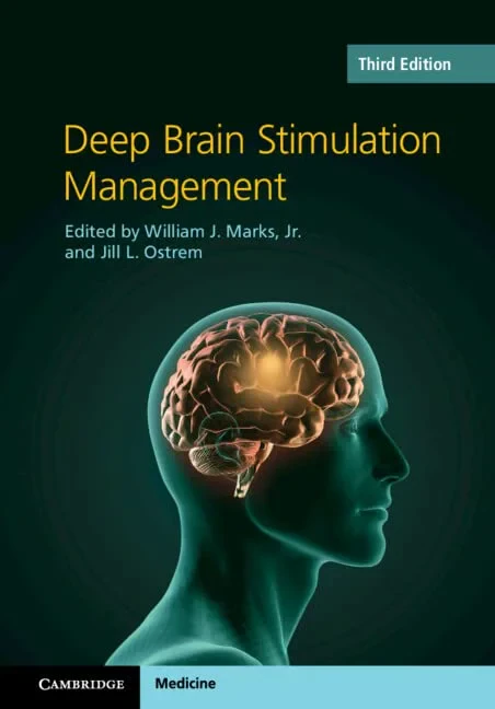 Coperta cărții "Deep Brain Stimulation Management" de William J. Marks, Jill L. Ostrem