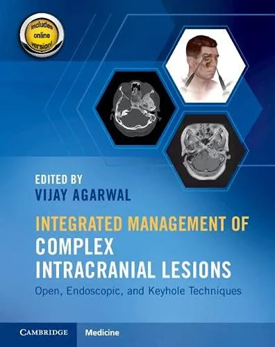 Coperta cărții "Integrated Management of Complex Intracranial Lesions" de Vijay Agarwal