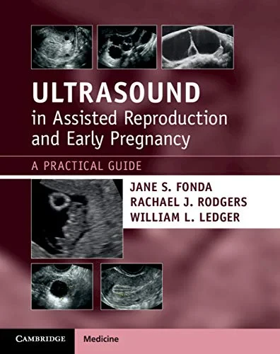 Coperta cărții "Ultrasound in Assisted Reproduction and Early Pregnancy: A Practical Guide" de William L. Ledger, Jane S. Fonda, Rachael J. Rodgers