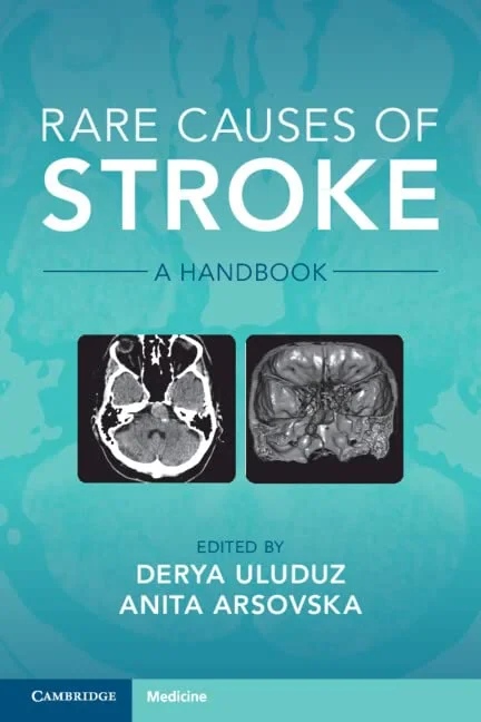 Coperta cărții "Rare Causes of Stroke: A Handbook" de Anita Arsovska