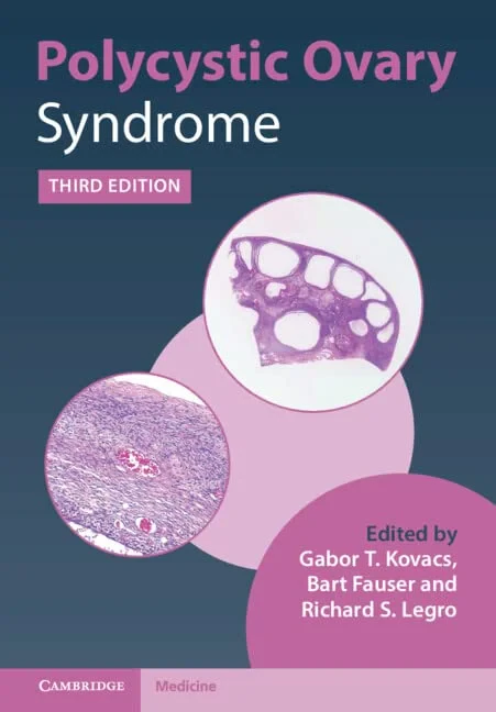 Coperta cărții "Polycystic Ovary Syndrome" de Gabor T. Kovacs, Bart Fauser, Richard S. Legro