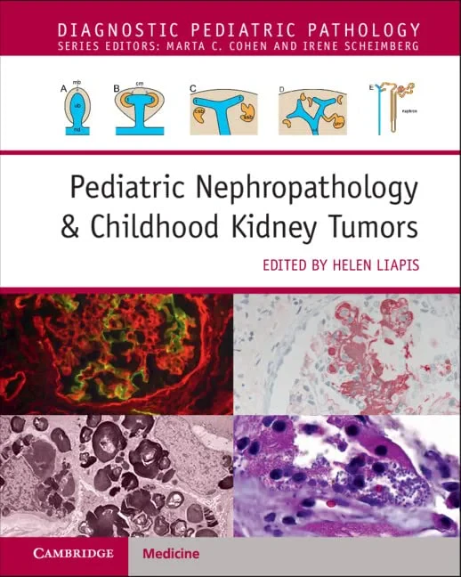 Coperta cărții "Pediatric Nephropathology &amp; Childhood Kidney Tumors with Online Resource" de Helen Liapis