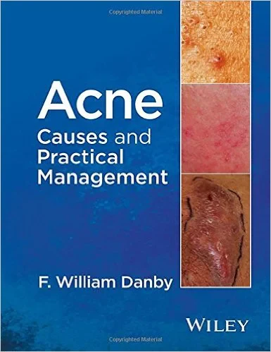 Coperta cărții "Acne: Causes and Practical Management 1st Edition" de F. William Danby
