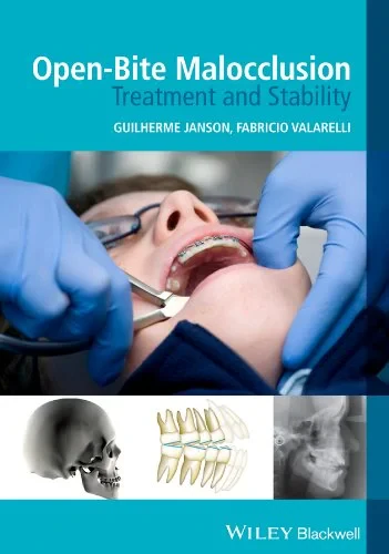 Coperta cărții "Open–Bite Malocclusion – Treatment and Stability" de Guilherme Janson, Fabricio Valarelli