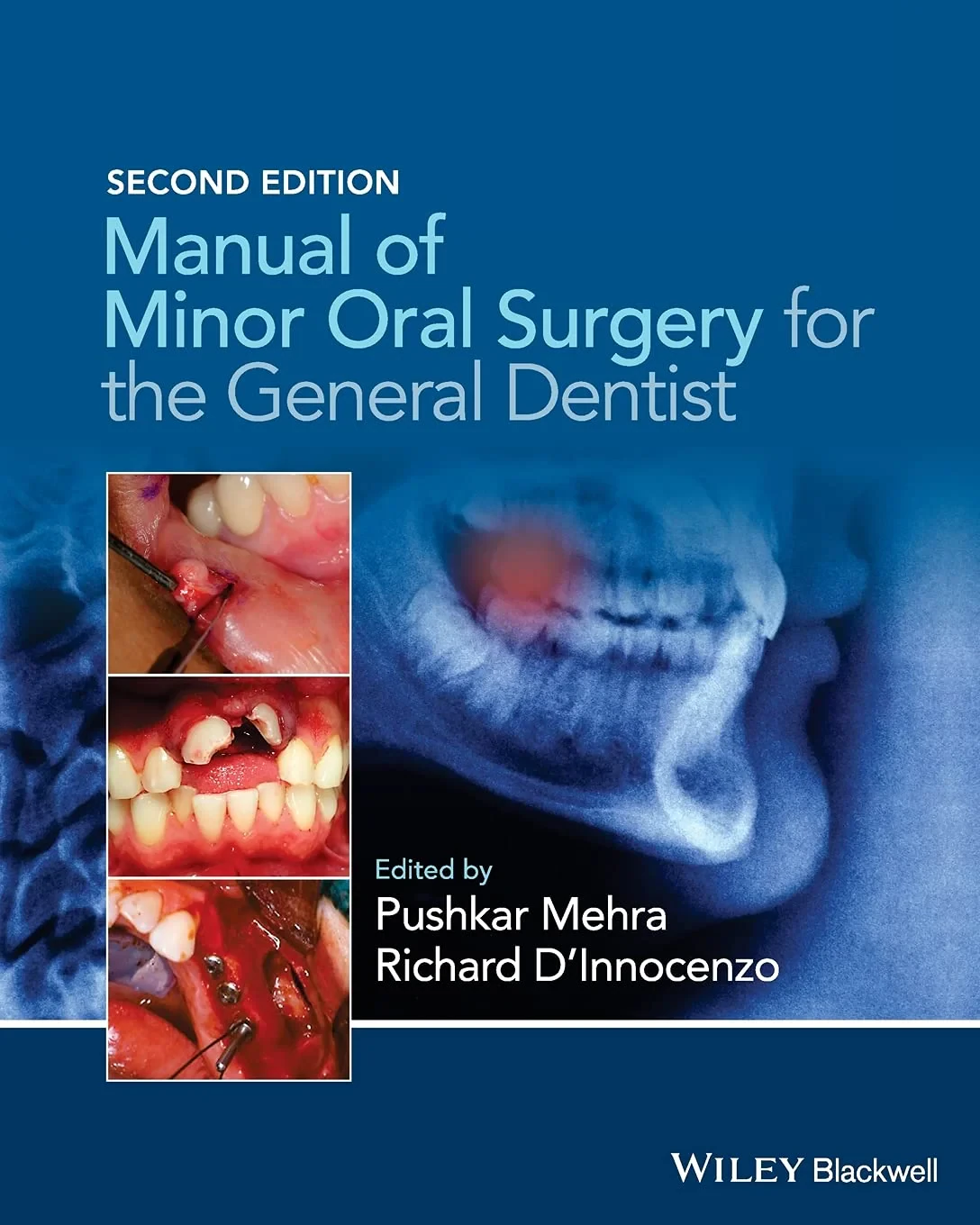 Coperta cărții "Manual of Minor Oral Surgery for the General Dentist" de Pushkar Mehra, Richard D'Innocenzo