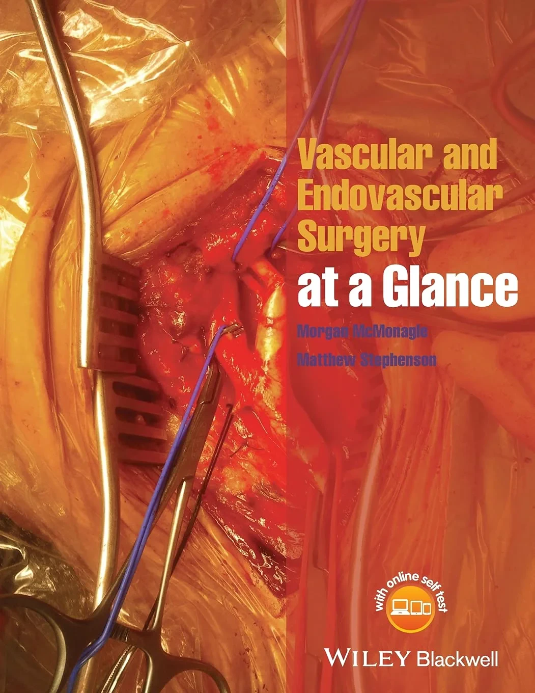 Coperta cărții "Vascular and Endovascular Surgery at a Glance " de Morgan McMonagle
