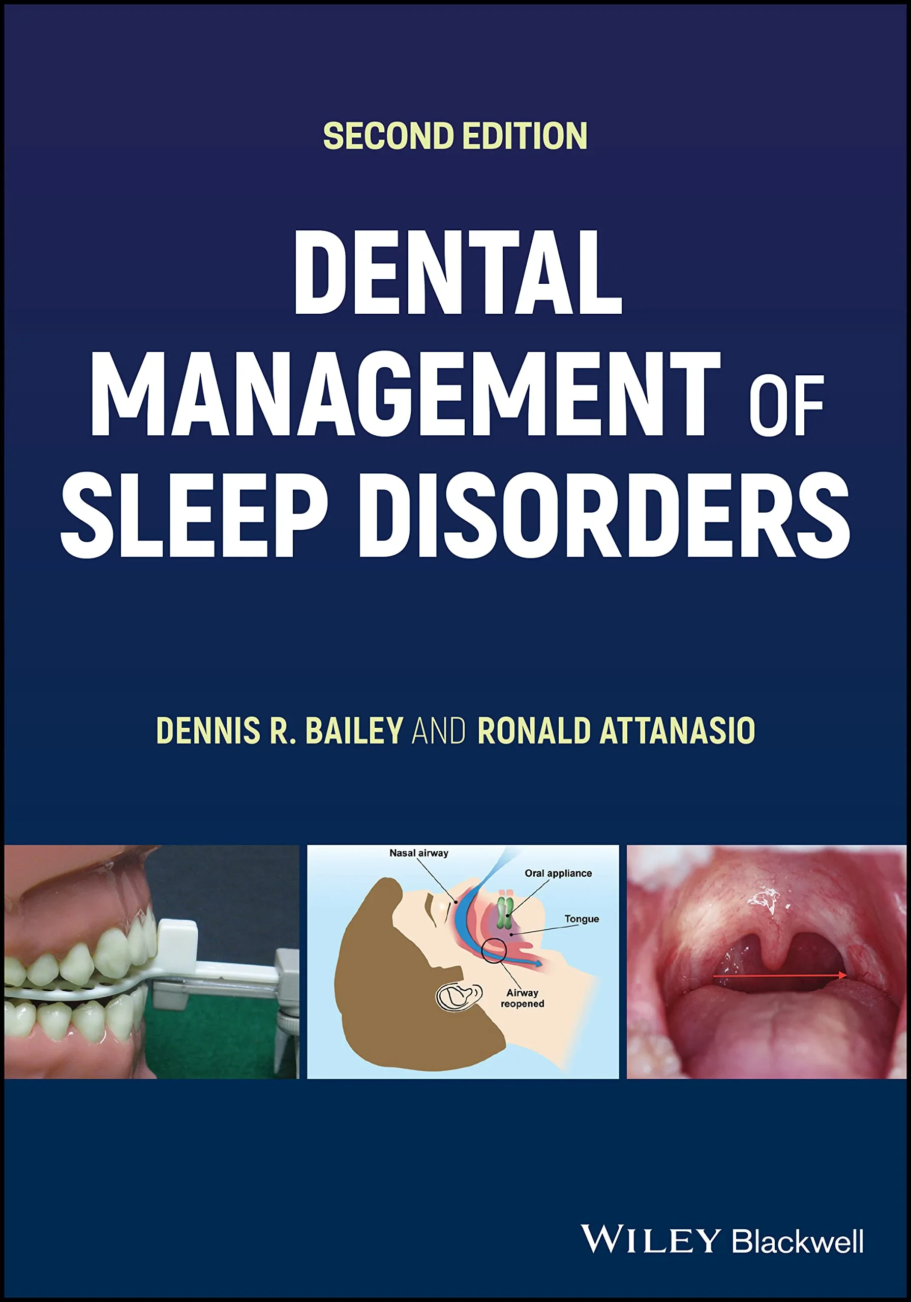 Coperta cărții "Dental Management of Sleep Disorders " de Dennis R. Bailey