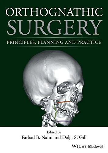 Orthognathic Surgery: Principles, Planning and Pra...