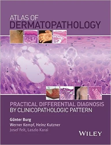 Coperta cărții "Atlas of Dermatopathology: Practical Differential Diagnosis by Clinicopathologic Pattern 1st Edition" de Gunter Burg, Werner Kempf, Heinz Kutzner, Josef Feit, Laszlo Karai