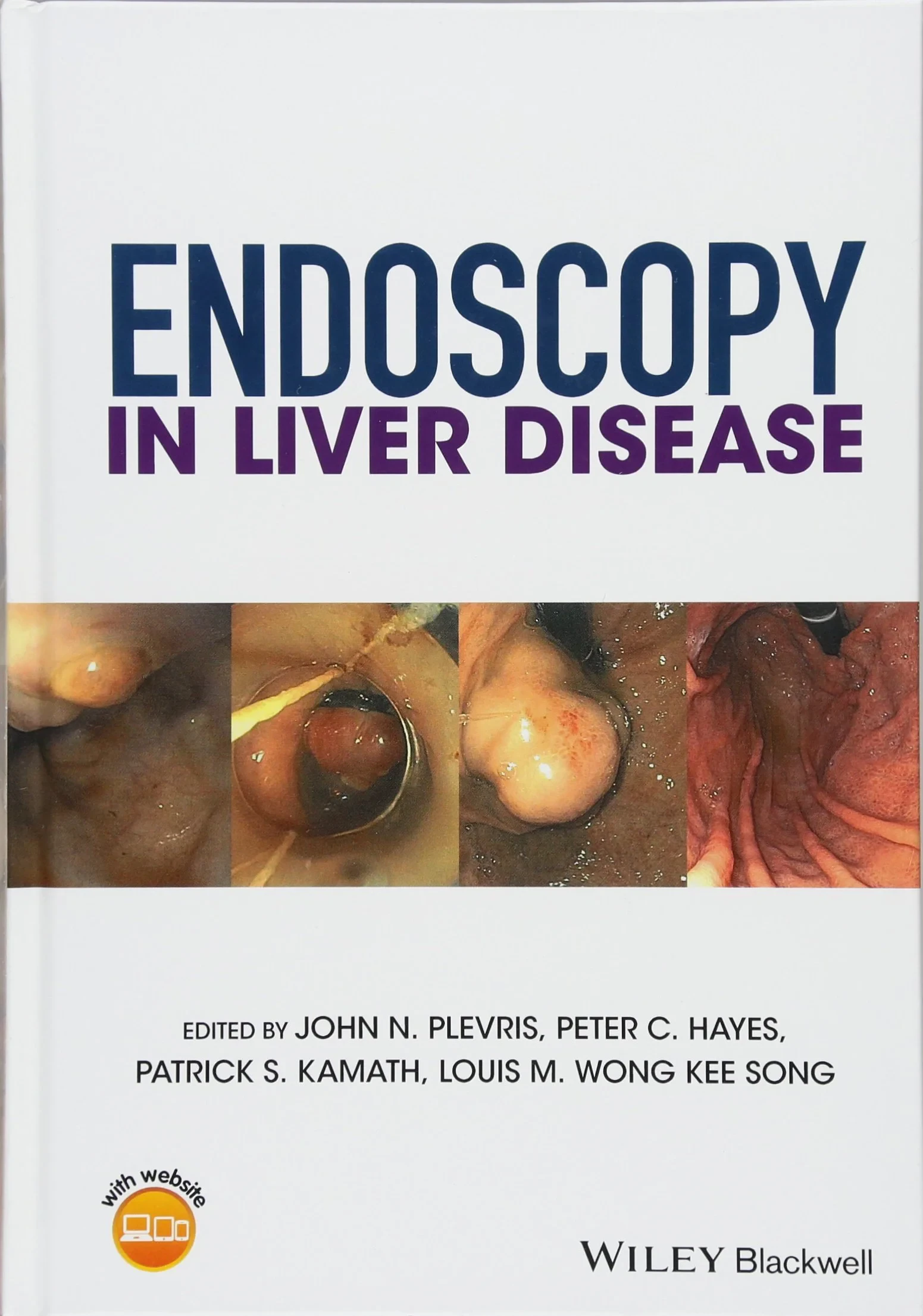 Coperta cărții "Endoscopy in Liver Disease" de John N. Plevris, Peter C. Hayes, Patrick S. Kamath, Louis&amp;#150;Michel Wong Kee Song, Louis–Michel Wong Kee Song