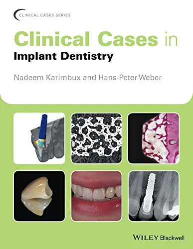 Coperta cărții "Clinical Cases in Implant Dentistry" de Nadeem Karimbux, Hans-Peter Weber
