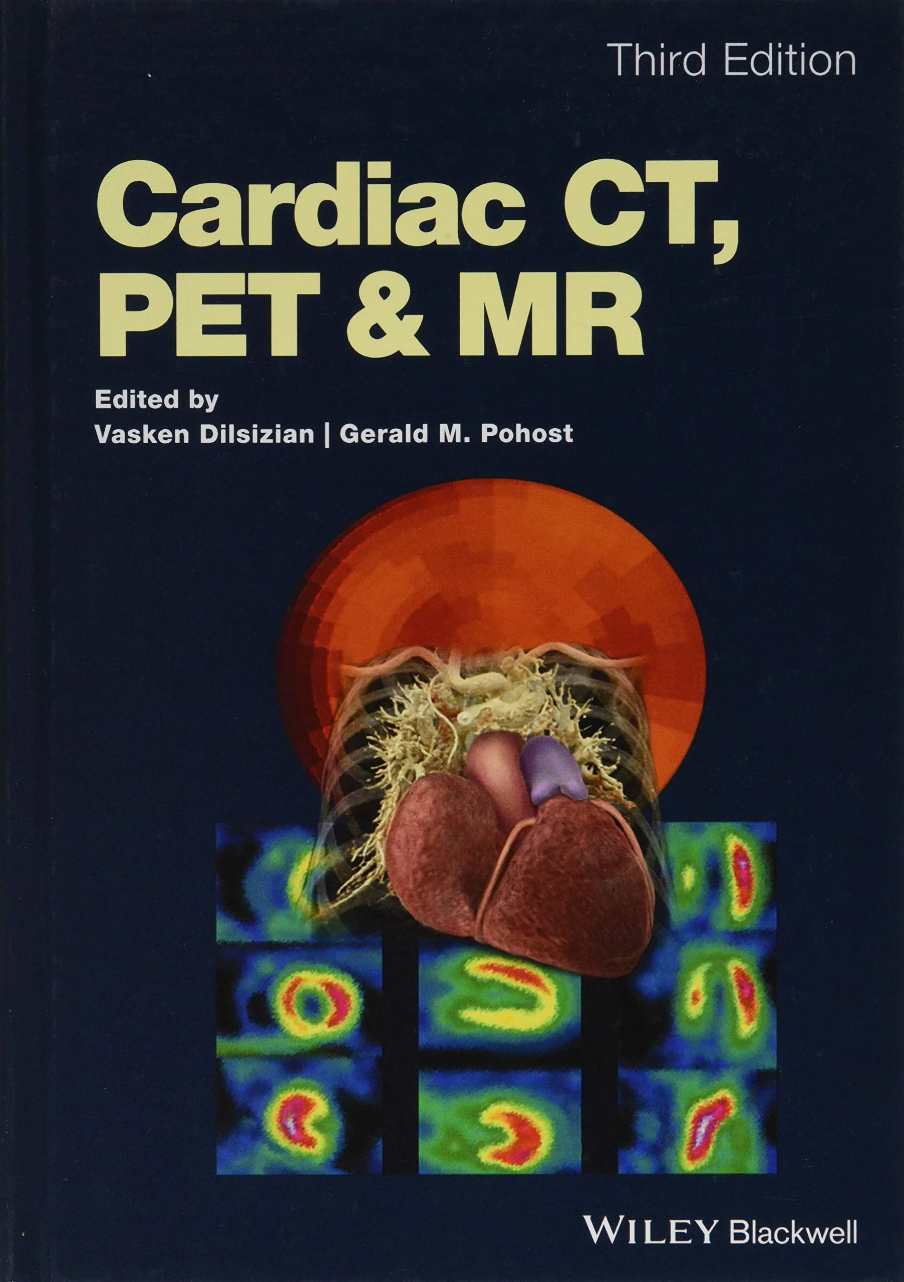 Coperta cărții "Cardiac CT, PET and MR" de Gerald M. Pohost, Vasken Dilsizian