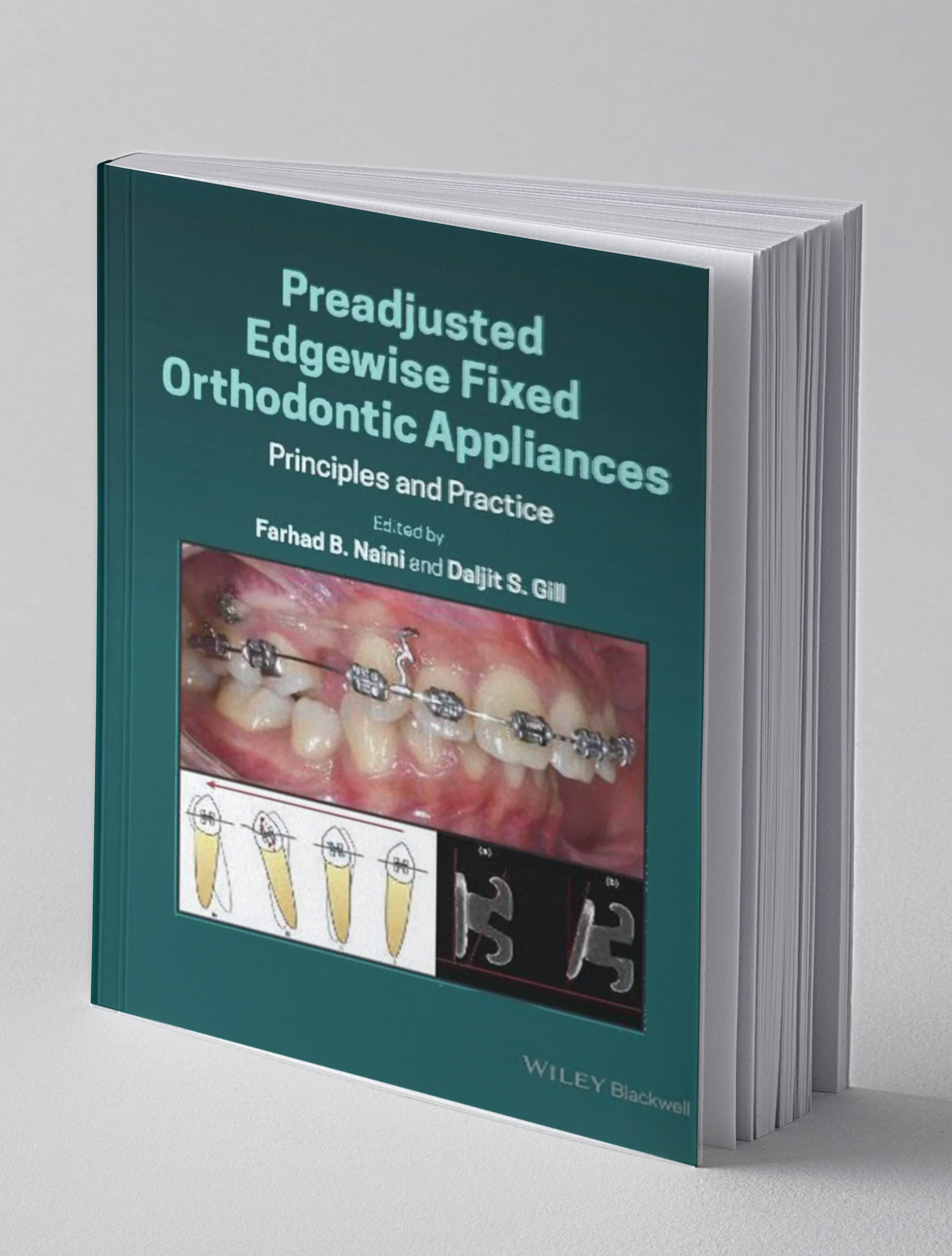 Coperta cărții "Preadjusted Edgewise Fixed Orthodontic Appliances: Principles and Practice" de Farhad B. Naini, Daljit S. Gill