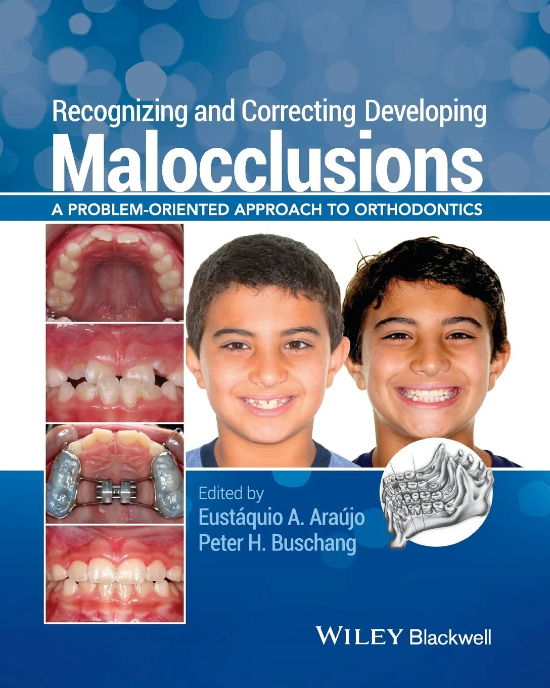 Coperta cărții "Recognizing and Correcting Developing Malocclusions: A Problem-Oriented Approach to Orthodontics" de Araújo