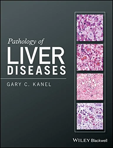 Coperta cărții "Pathology of Liver Diseases" de Gary C. Kanel