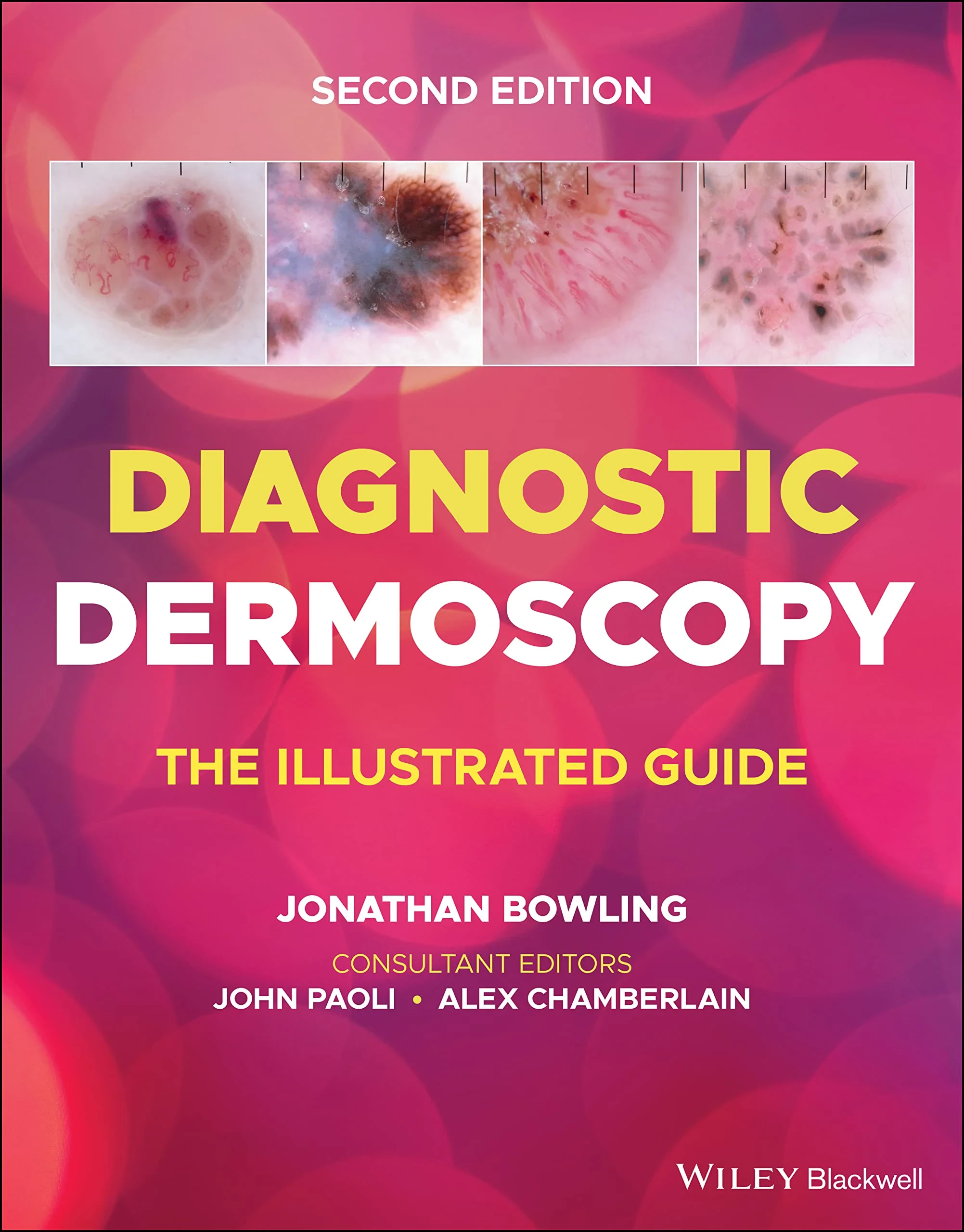 Coperta cărții "Diagnostic Dermoscopy – The Illustrated Guide, 2e" de J Bowling