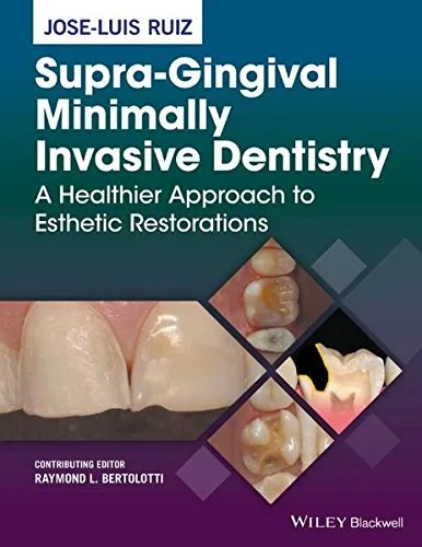 Coperta cărții "Supra-Gingival Minimally Invasive Dentistry: A Healthier Approach to Esthetic Restorations" de Jose-Luis Ruiz
