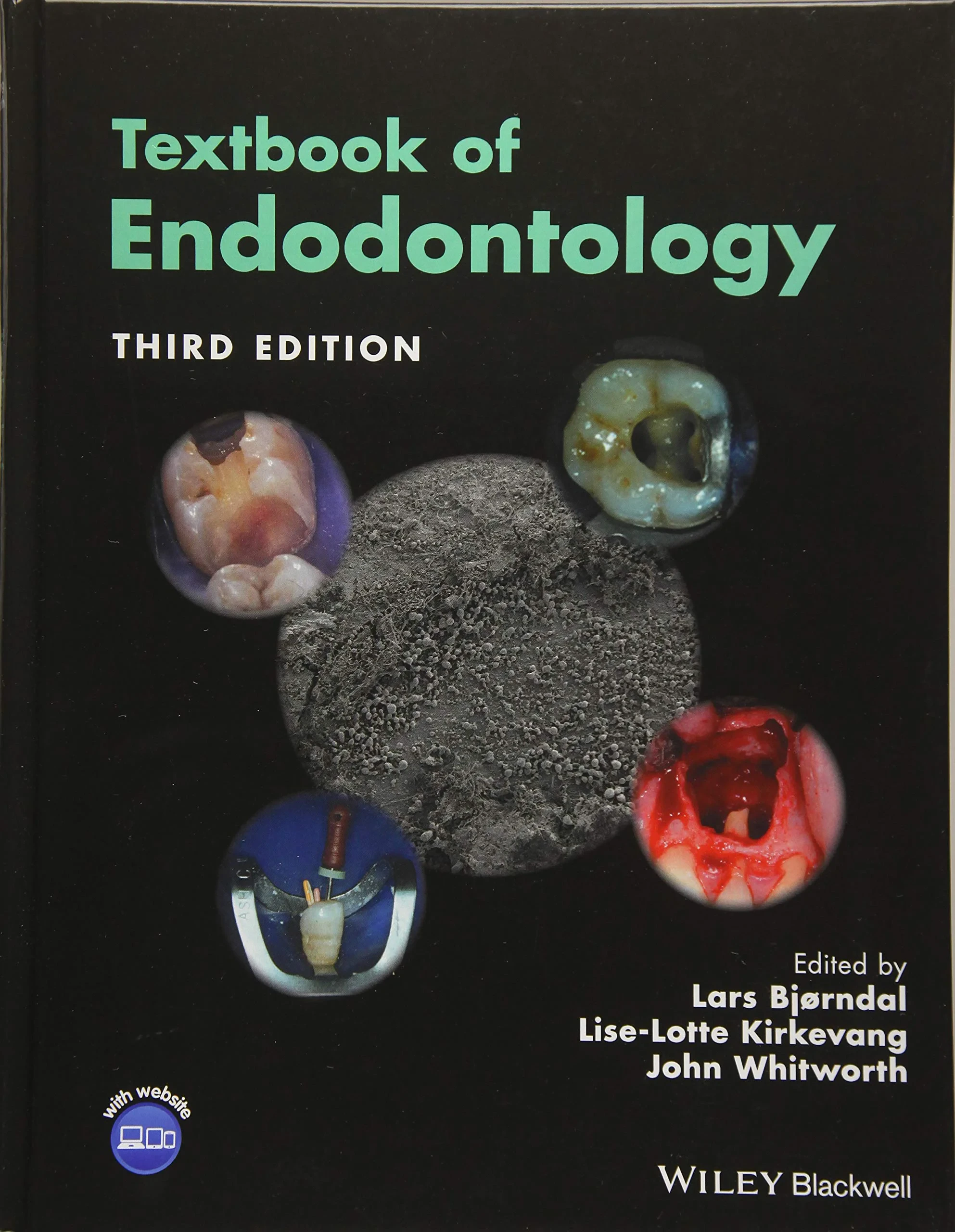 Coperta cărții "Textbook of Endodontology" de Lise-Lotte Kirkevang, John Whitworth, Lars Bjørndal