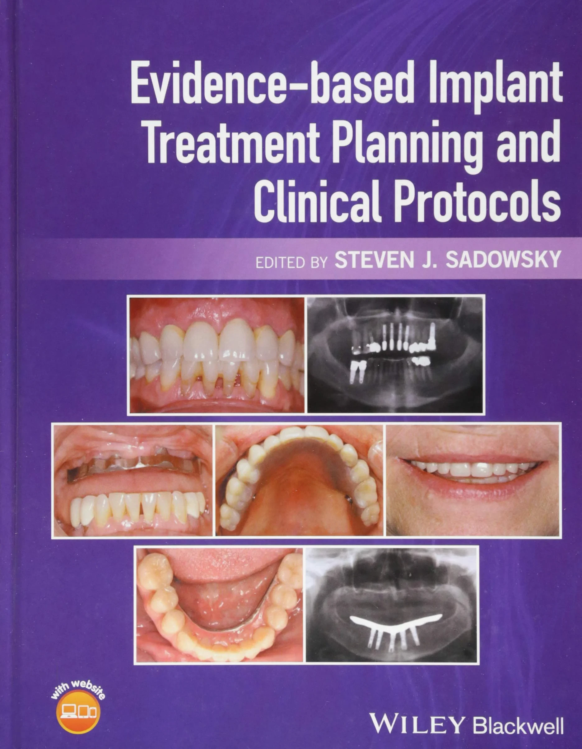 Coperta cărții "Evidence-Based Implant Treatment Planning and Clinical Protocols " de Steven J. Sadowsky