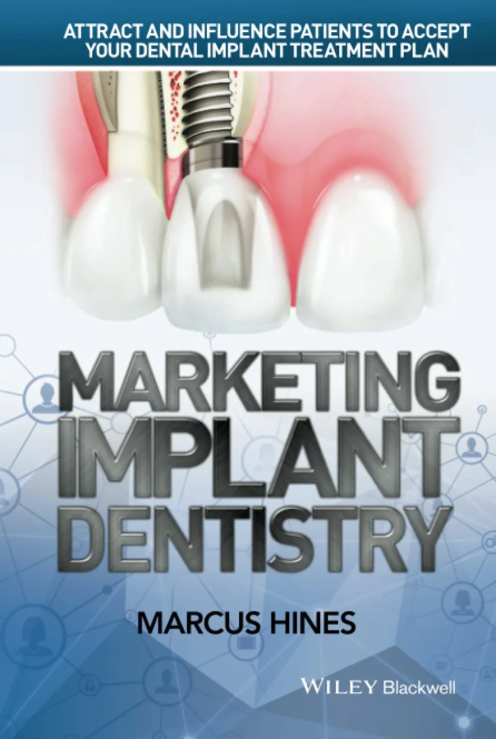 Coperta cărții "Marketing Implant Dentistry" de Marcus Hines