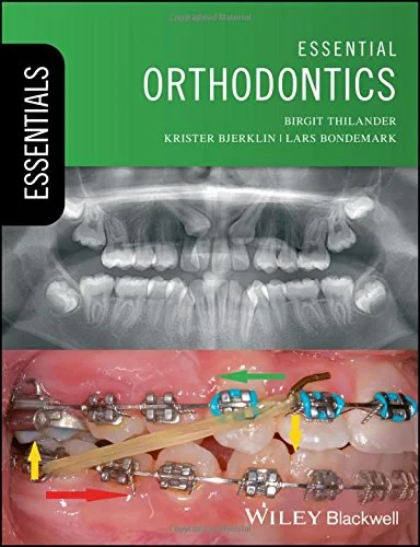 Coperta cărții "Essential Orthodontics" de Birgit Thilander, Krister Bjerklin, Lars Bondemark