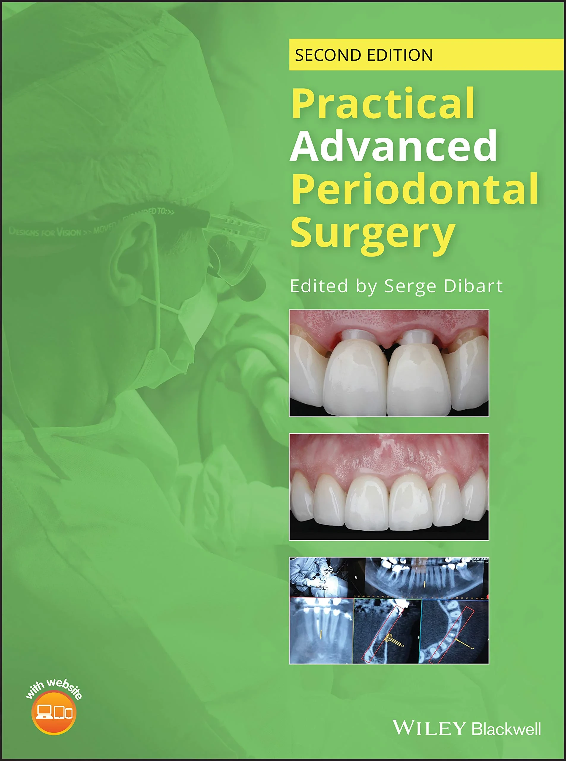 Coperta cărții "Practical Advanced Periodontal Surgery" de Serge Dibart