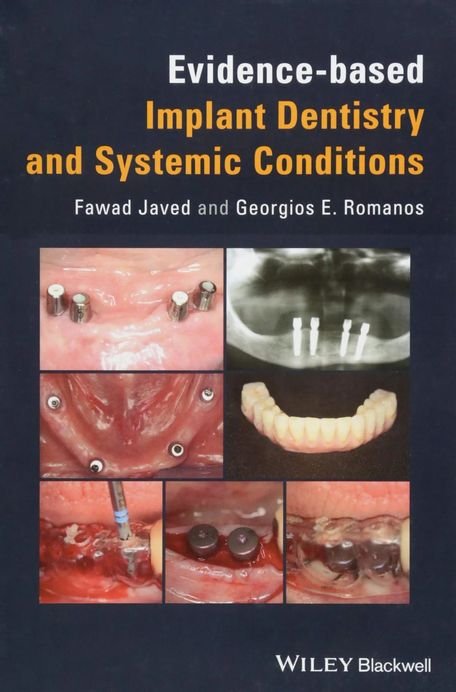 Coperta cărții "Evidence–based Implant Dentistry and Systemic Conditions" de Georgios E. Romanos, Fawad Javed