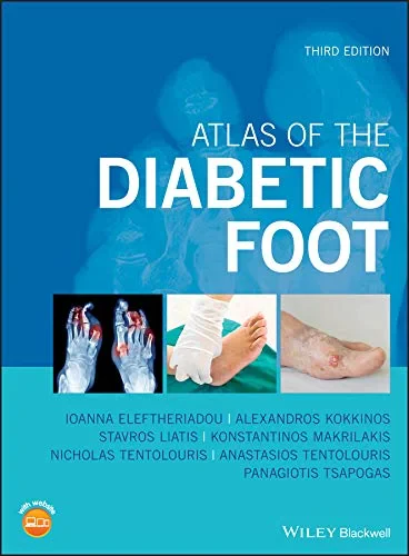 Coperta cărții "Atlas of the Diabetic Foot" de Ioanna Eleftheriadou, Alexandros Kokkinos, Stavros Liatis, Konstantinos Makrilakis), Nicholas Tentolouris, Anastasios Tentolouris