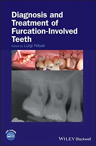 Coperta cărții "Diagnosis and Treatment of Furcation-Involved Teeth" de L Nibali