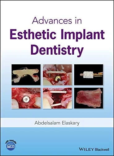 Coperta cărții "Advances in Esthetic Implant Dentistry" de Abdelsalam Elaskary
