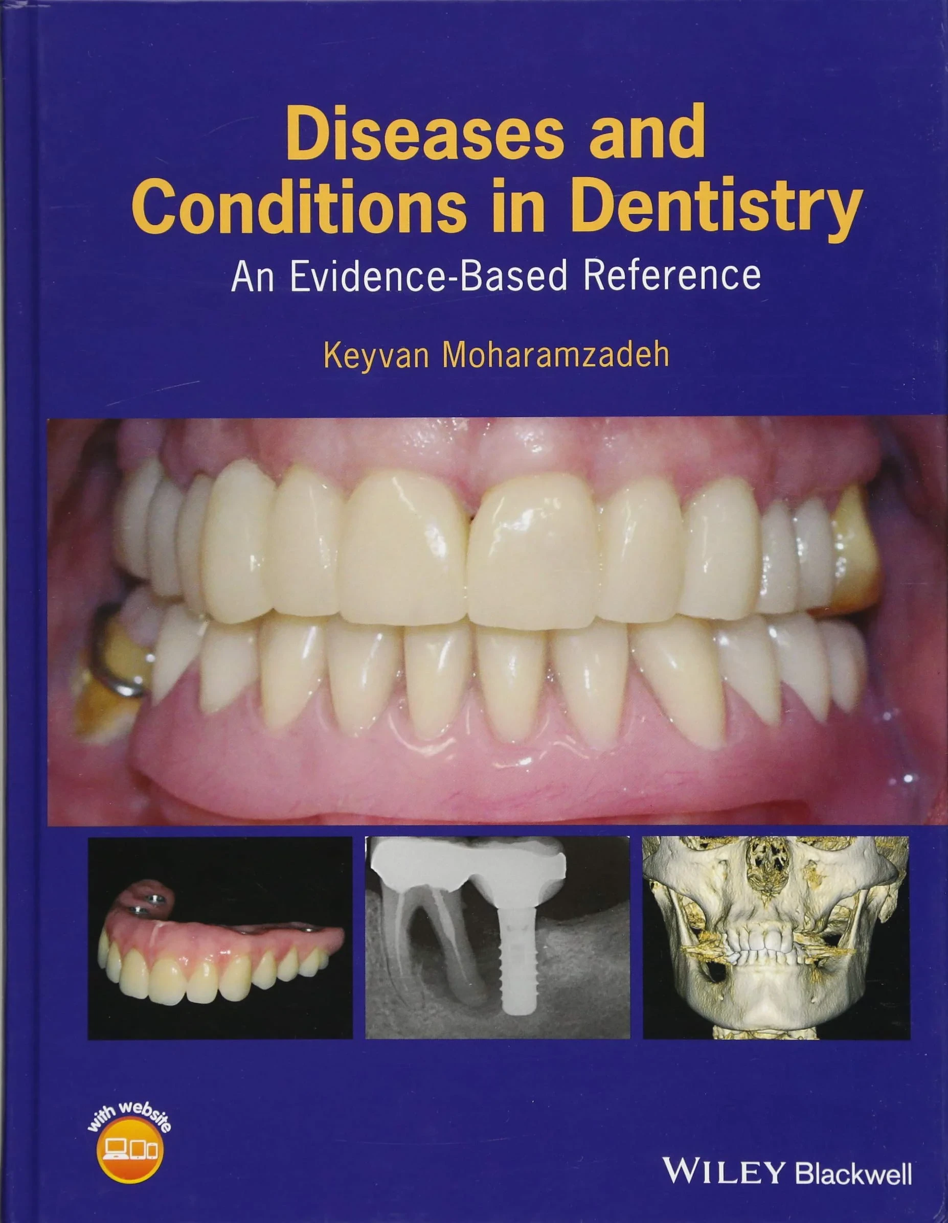 Coperta cărții "Diseases and Conditions in Dentistry: An Evidence–Based Reference " de Keyvan Moharamzadeh