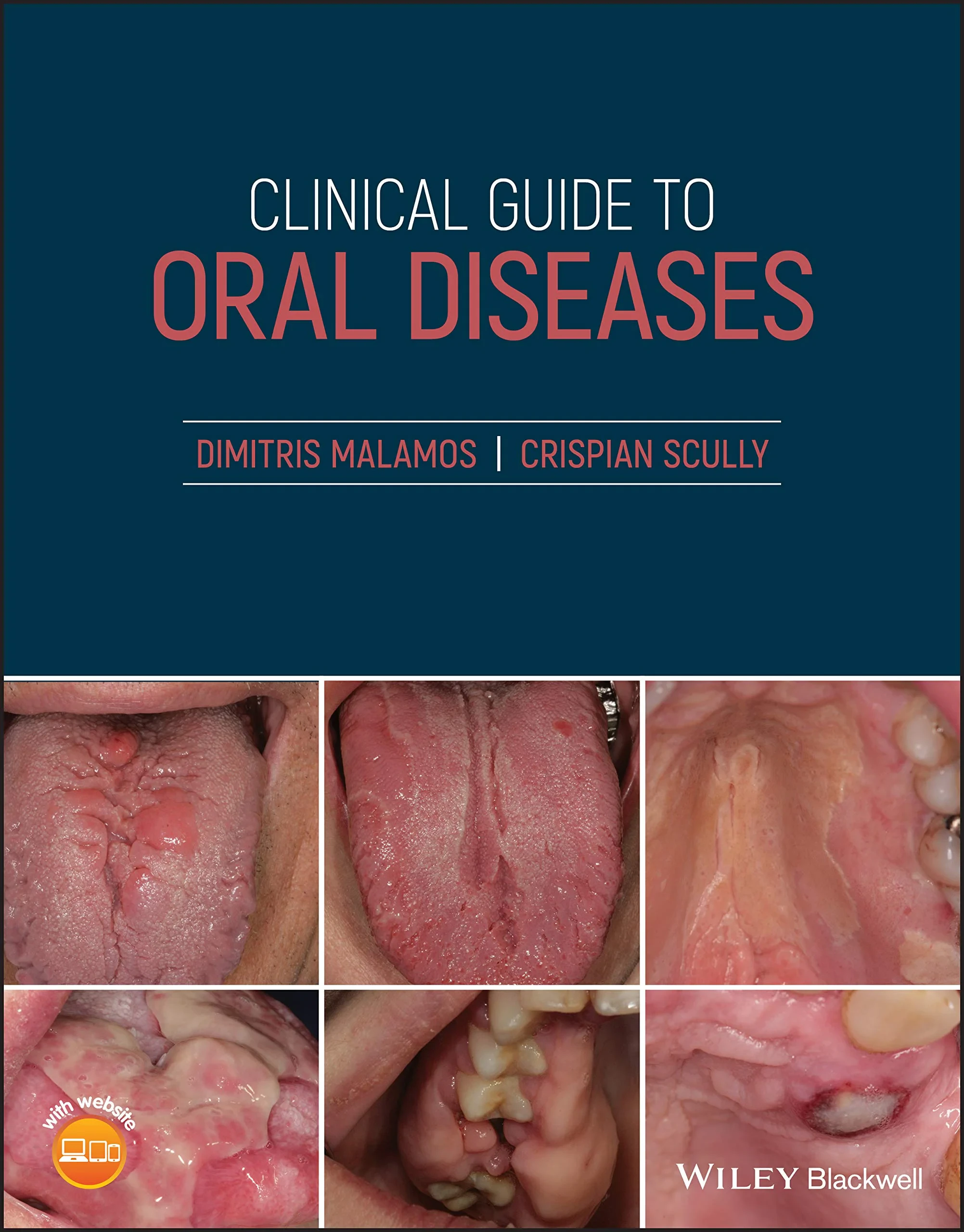 Coperta cărții "Clinical Guide to Oral Diseases " de Crispian Scully, Dimitris Malamos