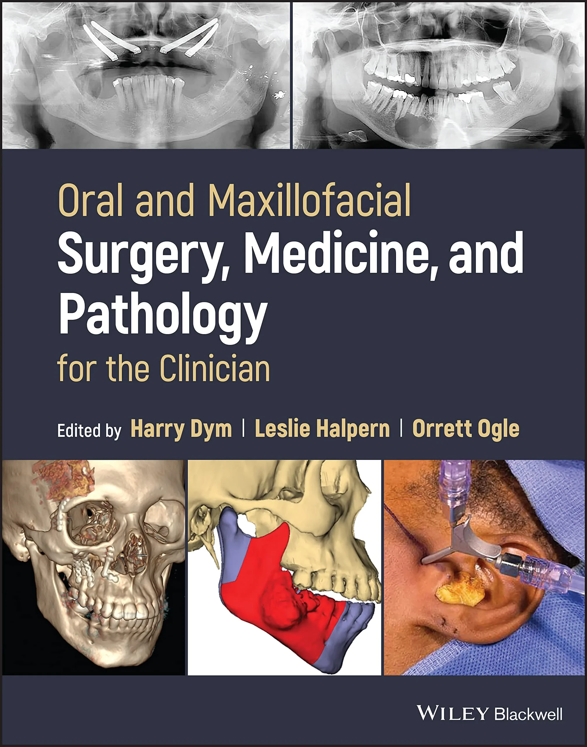Coperta cărții "Oral and Maxillofacial Surgery, Medicine, and Pathology for the Clinician" de Dym