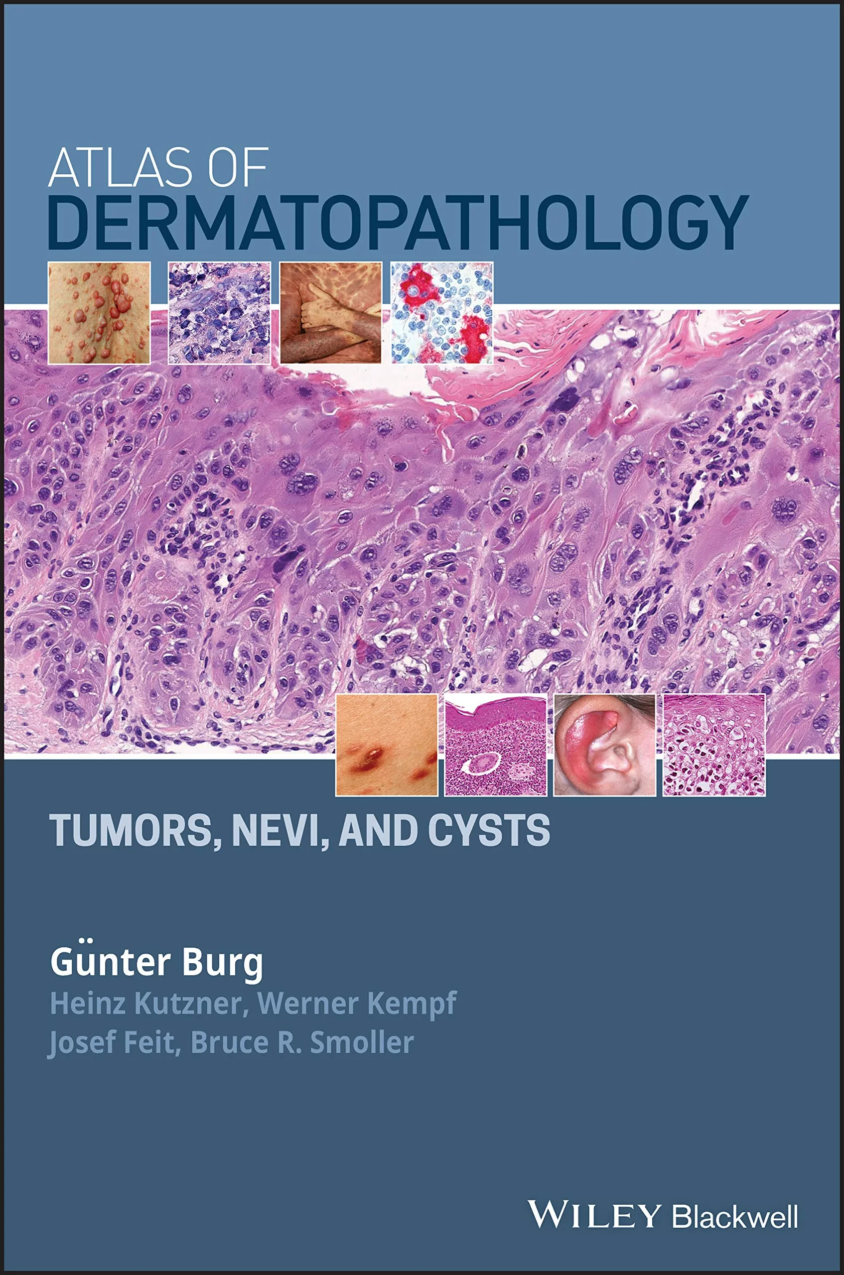Coperta cărții "Atlas of Dermatopathology: Tumors, Nevi, and Cysts" de Gunter Burg, Werner Kempf, Heinz Kutzner, Josef Feit, Bruce R. Smoller