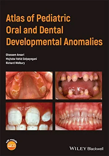 Coperta cărții "Atlas of Pediatric Oral and Dental Developmental Anomalies" de Ghassem Ansari, Mojtaba Vahid Golpayegani, Richard Welbury